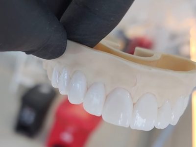 FOTO DISEÑO SONRISA (1) FOTO DISEÑO SONRISA (1)