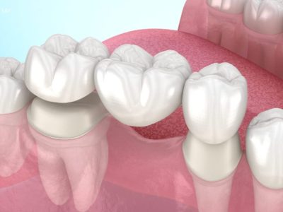 FOTO REHABILOTACION (1) FOTO REHABILOTACION (1)